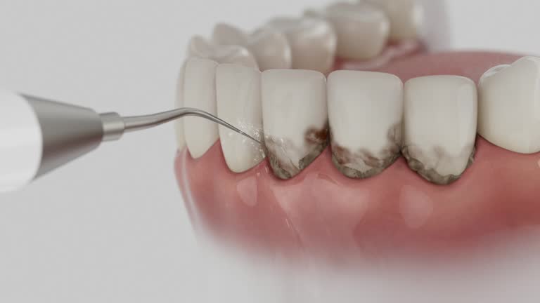 Trusted Dental Crowns And Bridges service in Potomac Mills, VA - Dentist Open Now